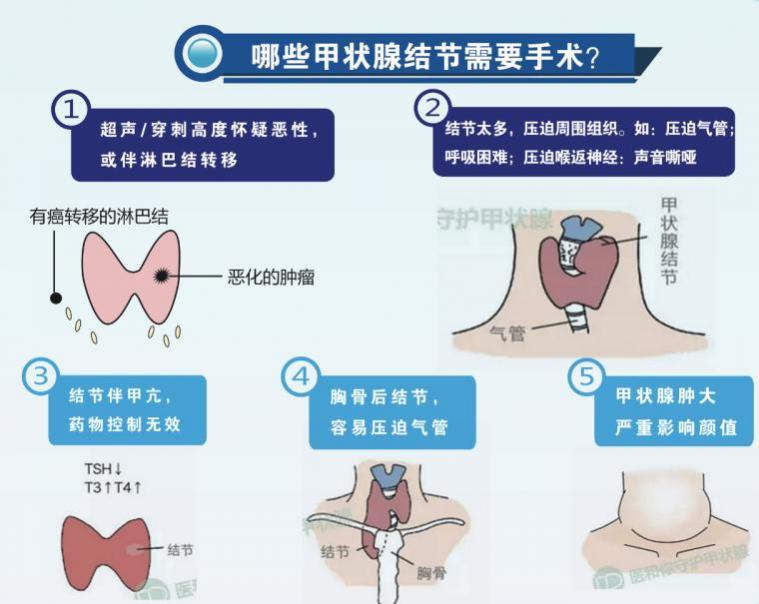 截屏2022-04-20 22.00.00.png